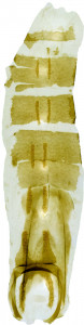 15 - 2818 Coleophora toxotis abd.